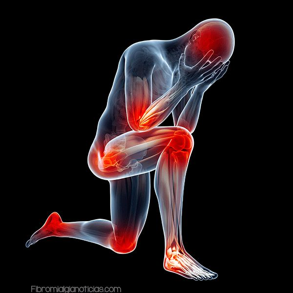 PILATES Y PREVENCIÓN DEL DOLOR CRÓNICO: QUÉ PODEMOS HACER ANTES DE QUE APAREZCA