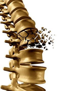 Columna vertebral mostrando los efectos del sedentarismo prolongado